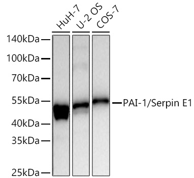 PAI-1/Serpin E1 Monoclonal Antibody [6L6Y7]