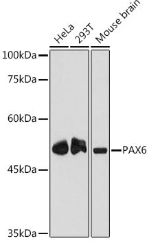 PAX6 Monoclonal Antibody