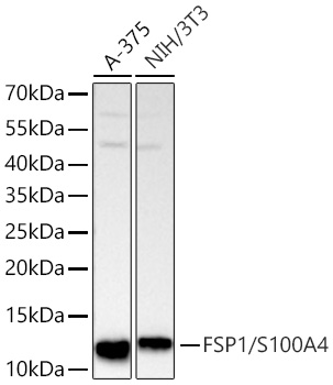 FSP1/S100A4 Monoclonal Antibody [8R2W0]