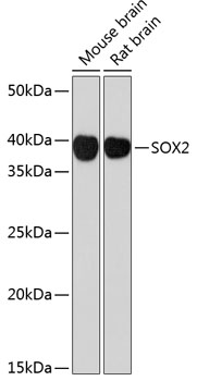 SOX2 Monoclonal Antibody