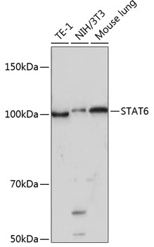 STAT6 Monoclonal Antibody [4G7J8]