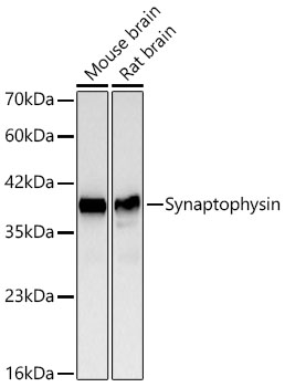 Synaptophysin Monoclonal Antibody