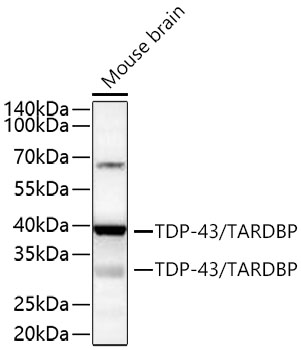 TDP-43/TARDBP Monoclonal Antibody [4R5L7]