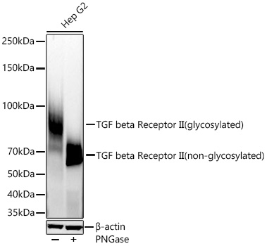 TGF beta Receptor II Monoclonal Antibody [2M8Y2]
