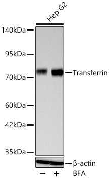Transferrin Monoclonal Antibody [1S7G8]