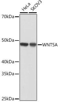 WNT5A Monoclonal Antibody [3P2E8]