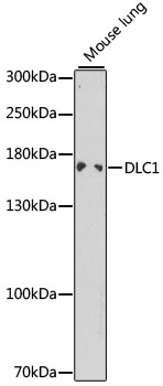 DLC1 Polyclonal Antibody