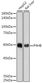 P4HB Monoclonal Antibody [10U5D5]
