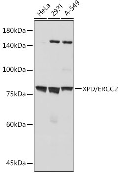 XPD/ERCC2 Monoclonal Antibody [6T9K6]