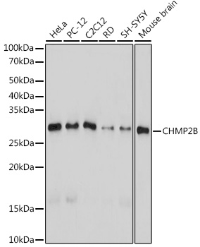 CHMP2B Monoclonal Antibody [3L9O5]