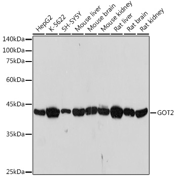 GOT2 Monoclonal Antibody [4J7O3]