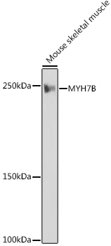 MYH7B Monoclonal Antibody [7W8J3]