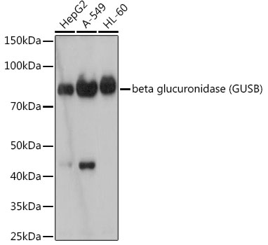 beta glucuronidase (GUSB) Monoclonal Antibody [4U0E2]