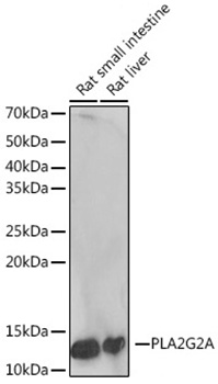 PLA2G2A Monoclonal Antibody [3X9F5]
