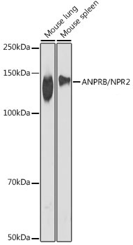 ANPRB/NPR2 Monoclonal Antibody [1S1H1]