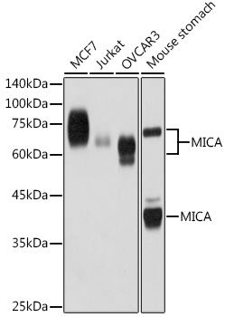 MICA Monoclonal Antibody [5A1P3]
