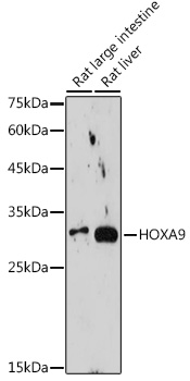 HOXA9 Monoclonal Antibody [9X1L6]