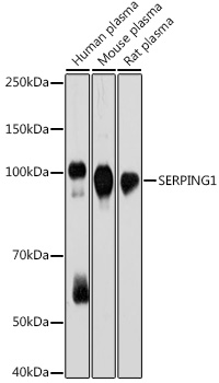 SERPING1 Monoclonal Antibody [0D3W8]