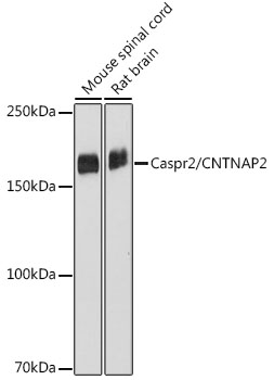 Caspr2/CNTNAP2 Monoclonal Antibody [2H2I5]