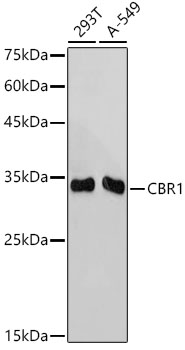 CBR1 Monoclonal Antibody [3A9O5]