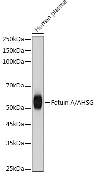 Fetuin A/AHSG Monoclonal Antibody [1A4W5]