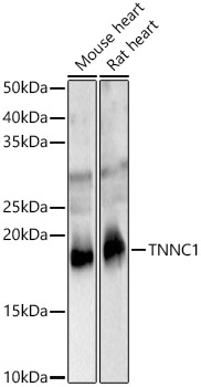 TNNC1 Polyclonal Antibody