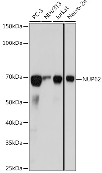 NUP62 Monoclonal Antibody [4V10S5]