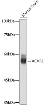 ACVR1 Monoclonal Antibody [1J7G4]