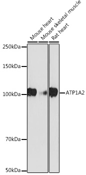 ATP1A2 Monoclonal Antibody [5T3O4]