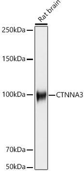 CTNNA3 Monoclonal Antibody [8F1U7]