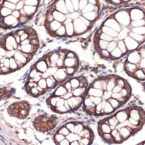CC2D1A Monoclonal Antibody [5Y6S6]