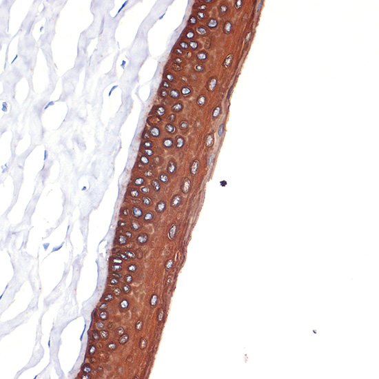 Cytokeratin 12 (KRT12) Monoclonal Antibody [2M1K10]