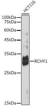 RCHY1 Monoclonal Antibody [4Q5H9]