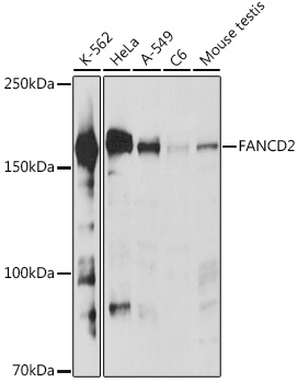 FANCD2 Polyclonal Antibody