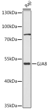 GJA8 Polyclonal Antibody