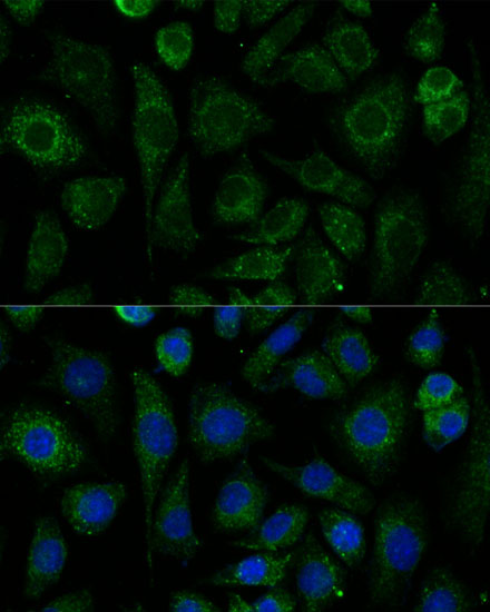 NDUFAB1 Polyclonal Antibody