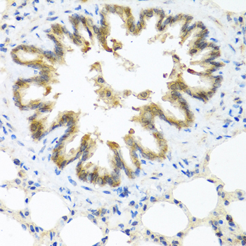 S100A7/Psoriasin Polyclonal Antibody