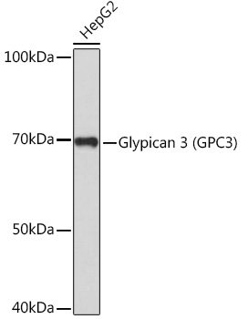 Glypican 3 (GPC3) Polyclonal Antibody
