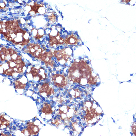 UCP1+UCP3 Monoclonal Antibody [0S10O10]
