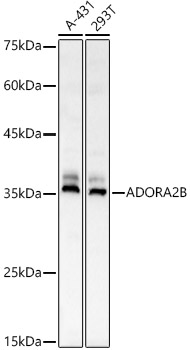 ADORA2B Polyclonal Antibody&nbsp;<img src="images/icon_newarrival.gif" alt="new" border="0">