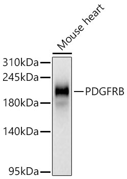 PDGFRB Monoclonal Antibody [6E8C10]