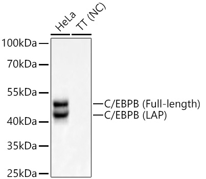 C/EBPB Monoclonal Antibody [9W4A10]