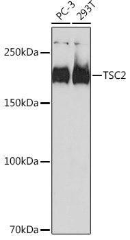 TSC2 Monoclonal Antibody [7X2C6]