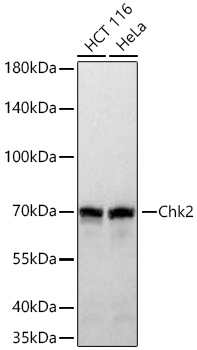 Chk2 Monoclonal Antibody [2W5N3]