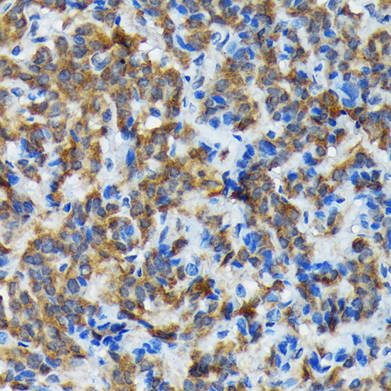 Thyroid Peroxidase Monoclonal Antibody [3C4A4]