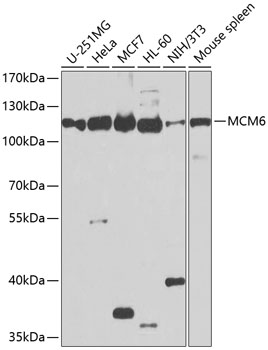 MCM6 Polyclonal Antibody