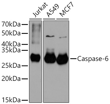 Caspase-6 Monoclonal Antibody [6D7S2]