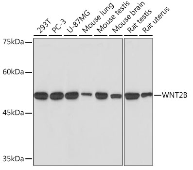 WNT2B Monoclonal Antibody [9M6O7]