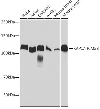 KAP1/TRIM28 Monoclonal Antibody [7C6M4]