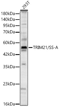 TRIM21/SS-A Polyclonal Antibody